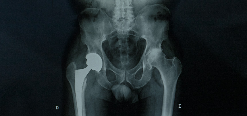 patologias traumatología donostia