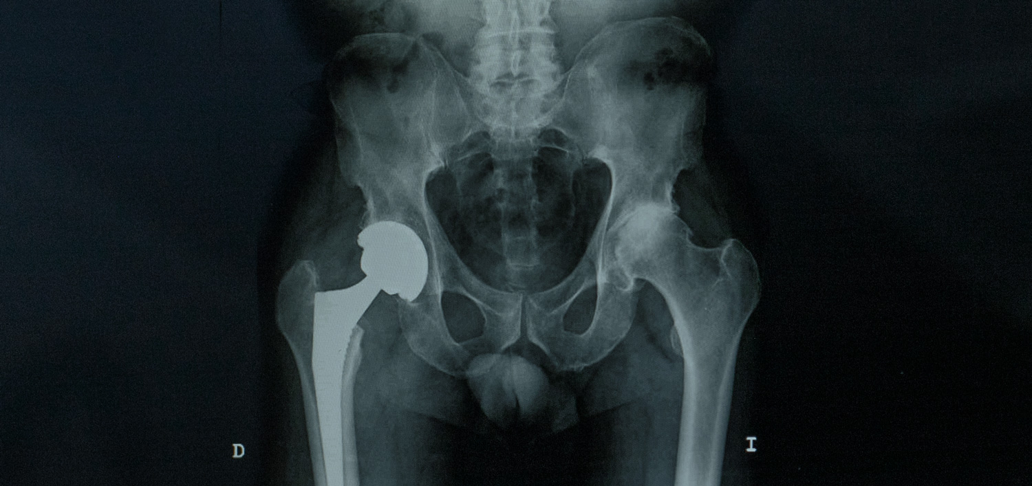 patologias traumatología donostia